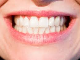 Etele Dental, a fogak egészségéért
